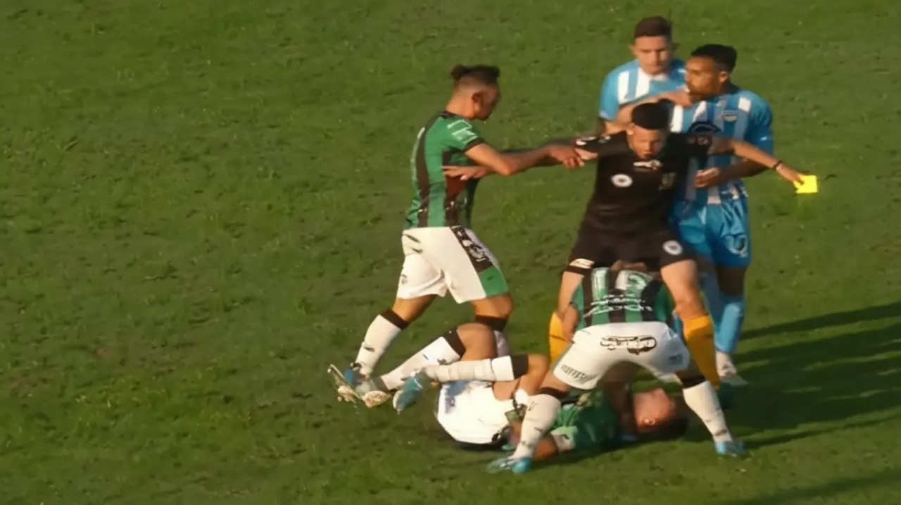 Un jugador de un equipo de segunda división recibió un golpe brutal en la pierna, lo que provocó una grave lesión que le dejó el pie inútil.. Foto: Redacción InfoArticulos